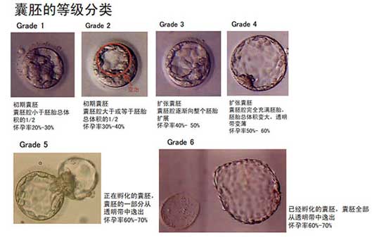 囊胚的等级分类