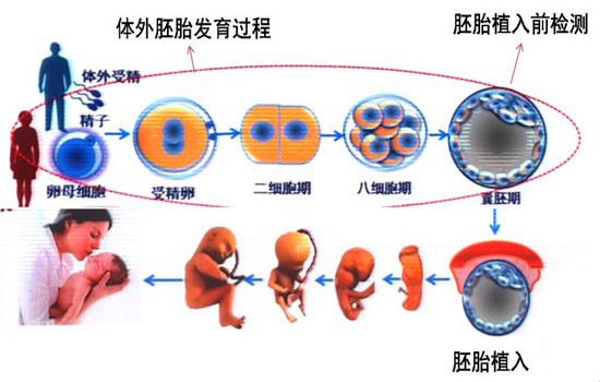 第三代试管婴儿技术流程图