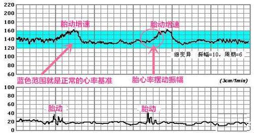 怀孕多长时间能有胎心